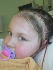 Megan Post Op
